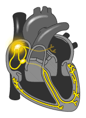 “解剖”冷冻式除湿机的心脏——压缩机